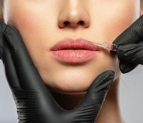 botox-1